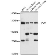 Western blot analysis of various lysates using IPO9 Antibody at 1/3000 dilution. Secondary antibody: HRP-conjugated Goat anti-Rabbit IgG (H+L) at 1/10000 dilution. Lysates/proteins: 25 µg per lane. Blocking buffer: 3% nonfat dry milk in TBST. Exposure time: 5s.
