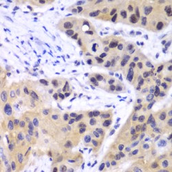 Interferon Regulatory Factor 3 (IRF3) Antibody