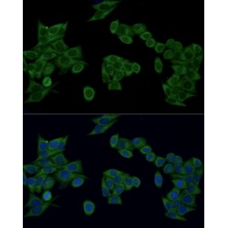 Interferon Regulatory Factor 3 (IRF3) Antibody