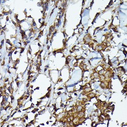 Tyrosine-Protein Kinase JAK2 (JAK2) Antibody