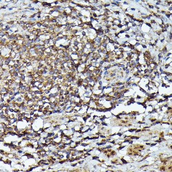 Tyrosine-Protein Kinase JAK2 (JAK2) Antibody