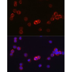 Tyrosine-Protein Kinase JAK3 (JAK3) Antibody