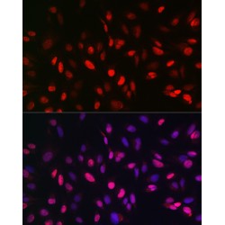 Lysine-Specific Demethylase 3A (KDM3A) Antibody