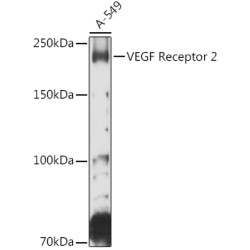 Kinase Insert Domain Receptor (KDR) Antibody