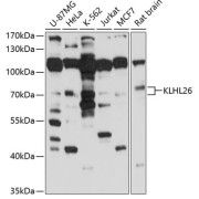 Western blot analysis of various lysates using KLHL26 Antibody at 1/1000 dilution. Secondary antibody: HRP-conjugated Goat anti-Rabbit IgG (H+L) at 1/10000 dilution. Lysates/proteins: 25 µg per lane. Blocking buffer: 3% nonfat dry milk in TBST. Exposure time: 10s.