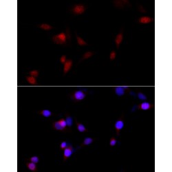 Lysine Methyltransferase 2A (KMT2A) Antibody