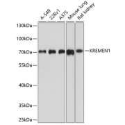Western blot analysis of various lysates using KREMEN1 Antibody at 1/1000 dilution. Secondary antibody: HRP-conjugated Goat anti-Rabbit IgG (H+L) at 1/10000 dilution. Lysates/proteins: 25 µg per lane. Blocking buffer: 3% nonfat dry milk in TBST. Exposure time: 90s.