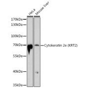 Western blot analysis of various lysates using Cytokeratin 2e (KRT2) Antibody at 1/1000 dilution. Secondary antibody: HRP-conjugated Goat anti-Rabbit IgG (H+L) at 1/10000 dilution. Lysates/proteins: 25 µg per lane. Blocking buffer: 3% nonfat dry milk in TBST. Exposure time: 90s.