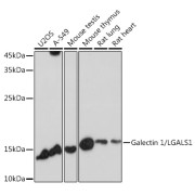 Western blot analysis of various lysates using Galectin 1/LGALS1 Antibody at 1/1000 dilution. Secondary antibody: HRP-conjugated Goat anti-Rabbit IgG (H+L) at 1/10000 dilution. Lysates/proteins: 25 µg per lane. Blocking buffer: 3% nonfat dry milk in TBST. Exposure time: 30s.