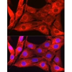 Galectin 1 (LGALS1) Antibody