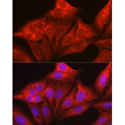 Galectin 1 (LGALS1) Antibody
