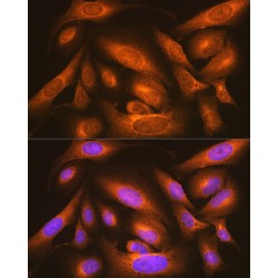 Protein ERGIC-53 (LMAN1) Antibody