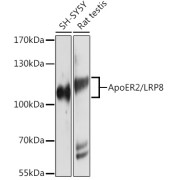 Western blot analysis of various lysates using ApoER2/LRP8 Antibody at 1/1000 dilution. Secondary antibody: HRP-conjugated Goat anti-Rabbit IgG (H+L) at 1/10000 dilution. Lysates/proteins: 25 µg per lane. Blocking buffer: 3% nonfat dry milk in TBST. Exposure time: 30s.