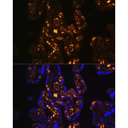 Low Density Lipoprotein Receptor Related Protein 8 (LRP8) Antibody
