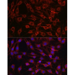 Myristoylated Alanine-Rich C-Kinase Substrate (MARCKS) Antibody
