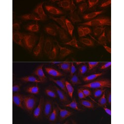 Myristoylated Alanine-Rich C-Kinase Substrate (MARCKS) Antibody