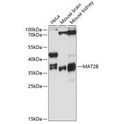 Western blot analysis of various lysates using MAT2B Antibody at 1/3000 dilution. Secondary antibody: HRP-conjugated Goat anti-Rabbit IgG (H+L) at 1/10000 dilution. Lysates/proteins: 25 µg per lane. Blocking buffer: 3% nonfat dry milk in TBST. Exposure time: 30s.