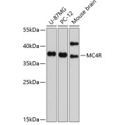 Western blot analysis of various lysates using MC4R Antibody at 1/1000 dilution. Secondary antibody: HRP-conjugated Goat anti-Rabbit IgG (H+L) at 1/10000 dilution. Lysates/proteins: 25 µg per lane. Blocking buffer: 3% nonfat dry milk in TBST. Exposure time: 90s.