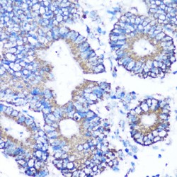 Matrix Metalloproteinase-16 (MMP16) Antibody