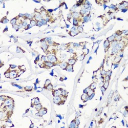 Matrix Metalloproteinase-16 (MMP16) Antibody