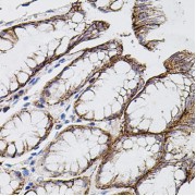abx126177