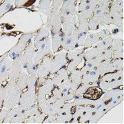 abx126179