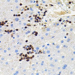 Matrix Metalloproteinase-9 (MMP9) Antibody