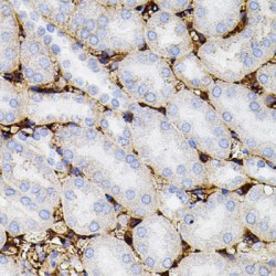 Matrix Metalloproteinase-9 (MMP9) Antibody