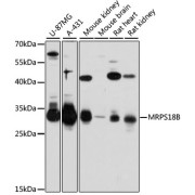 Western blot analysis of various lysates using MRPS18B Antibody at 1/3000 dilution. Secondary antibody: HRP-conjugated Goat anti-Rabbit IgG (H+L) at 1/10000 dilution. Lysates/proteins: 25 µg per lane. Blocking buffer: 3% nonfat dry milk in TBST. Exposure time: 30s.