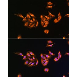 Mitochondrial Ribosomal Protein S27 (MRPS27) Antibody