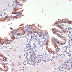 RNA-Binding Protein Musashi Homolog 1 (MSI1) Antibody