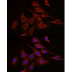 Serine/Threonine-Protein Kinase MTOR (MTOR) Antibody