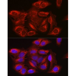 Serine/Threonine-Protein Kinase MTOR (MTOR) Antibody
