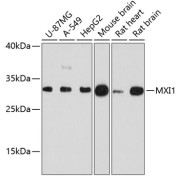 Western blot analysis of various lysates using MXI1 Antibody at 1/3000 dilution. Secondary antibody: HRP-conjugated Goat anti-Rabbit IgG (H+L) at 1/10000 dilution. Lysates/proteins: 25 µg per lane. Blocking buffer: 3% nonfat dry milk in TBST. Exposure time: 30s.