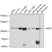 Western blot analysis of various lysates using MZF1 Antibody at 1/1000 dilution. Secondary antibody: HRP-conjugated Goat anti-Rabbit IgG (H+L) at 1/10000 dilution. Lysates/proteins: 25 µg per lane. Blocking buffer: 3% nonfat dry milk in TBST. Exposure time: 3s.