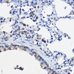 Nuclear Receptor Coactivator 2 (NCOA2) Antibody