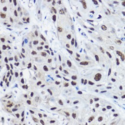 Nuclear Receptor Coactivator 2 (NCOA2) Antibody