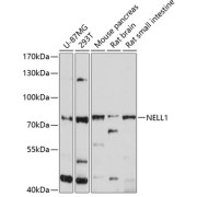 Western blot analysis of various lysates using NELL1 Antibody at 1/1000 dilution. Secondary antibody: HRP-conjugated Goat anti-Rabbit IgG (H+L) at 1/10000 dilution. Lysates/proteins: 25 µg per lane. Blocking buffer: 3% nonfat dry milk in TBST. Exposure time: 10s.