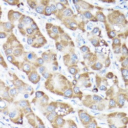 Nuclear Factor, Erythroid Derived 2 Like 2 (NFE2L2) Antibody
