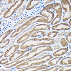 Nuclear Factor, Erythroid Derived 2 Like 2 (NFE2L2) Antibody