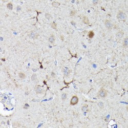 Nuclear Factor, Erythroid Derived 2 Like 2 (NFE2L2) Antibody