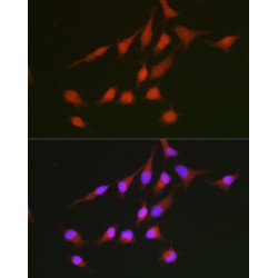 Nuclear Factor, Erythroid Derived 2 Like 2 (NFE2L2) Antibody