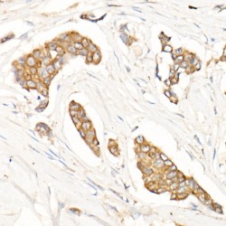 NF-Kappa-B Inhibitor Alpha (NFKBIA) Antibody