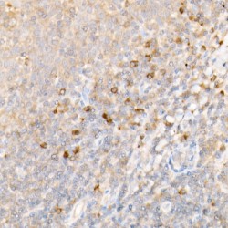 NF-Kappa-B Inhibitor Alpha (NFKBIA) Antibody