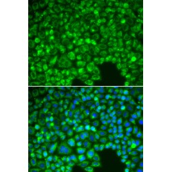 NF-Kappa-B Inhibitor Alpha (NFKBIA) Antibody