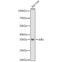 NF-Kappa-B Inhibitor Alpha (NFKBIA) Antibody