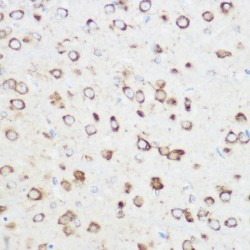 NODAL Modulator 1 (NOMO1) Antibody