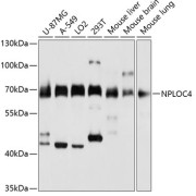 Western blot analysis of various lysates using NPLOC4 Antibody at 1/3000 dilution. Secondary antibody: HRP-conjugated Goat anti-Rabbit IgG (H+L) at 1/10000 dilution. Lysates/proteins: 25 µg per lane. Blocking buffer: 3% nonfat dry milk in TBST. Exposure time: 10s.