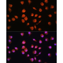 NPL4 Homolog, Ubiquitin Recognition Factor (NPLOC4) Antibody