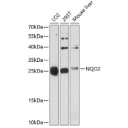 Western blot analysis of various lysates using NQO2 Antibody at 1/3000 dilution. Secondary antibody: HRP-conjugated Goat anti-Rabbit IgG (H+L) at 1/10000 dilution. Lysates/proteins: 25 µg per lane. Blocking buffer: 3% nonfat dry milk in TBST. Exposure time: 90s.